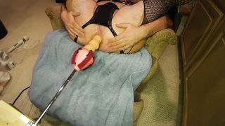 Taking the node again with a cummy complete