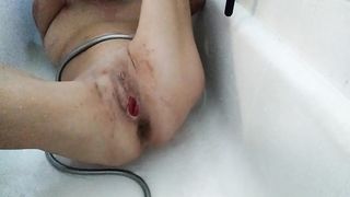 lizzy yum - lizzy yum post op slit and verification