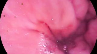 DEEP BUTTFUCK TESTING