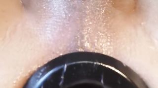 TRANS Rectal demolish (PSYKOANAL)