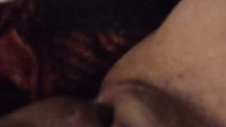 Furry Cunny Post Op Ladyboy Close Up