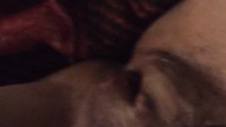 Furry Cunny Post Op Ladyboy Close Up