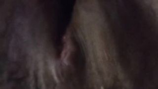 Furry Cunny Post Op Ladyboy Close Up