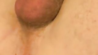 Amber TV with Gigantic Bum Speculum