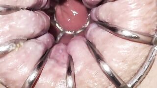 Reneenicolecd - update #30 - Gape butt sex open up cage - Apr nineteen, 2026