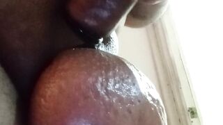 Saline ball latino scrotum 1
