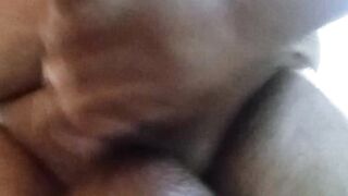 Saline ball latino scrotum 1