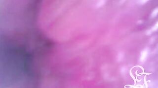 Investigating the Insides of my Backside with the Minicam!