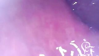 Investigating the Insides of my Backside with the Minicam!